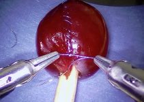 WATCH: Robot Used in Removing Tumors Stitches a Grape inside a Bottle