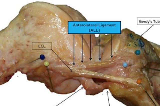 anterolateral ligament